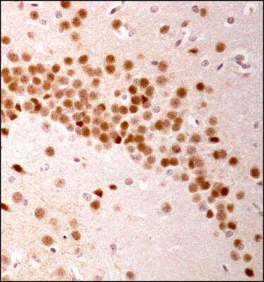 Immunohistochemistry: LRRK2 Antibody - BSA Free [NBP1-78299]