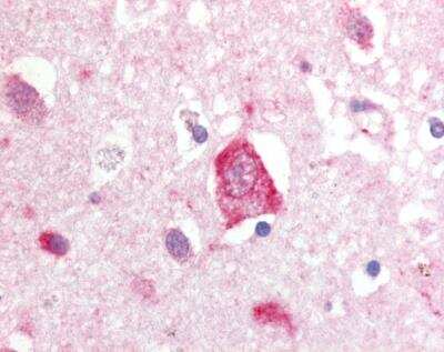 Immunohistochemistry-Paraffin: LRRK2 Antibody - BSA Free [NB300-268]