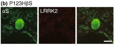 Immunohistochemistry-Paraffin: LRRK2 Antibody - BSA Free [NB300-268]