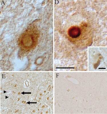 Immunohistochemistry-Paraffin: LRRK2 Antibody - BSA Free [NB300-268]