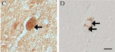 Immunohistochemistry-Paraffin: LRRK2 Antibody - BSA Free [NB300-268]