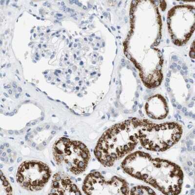 Immunohistochemistry-Paraffin: LRRK2 Antibody [NBP2-48524]