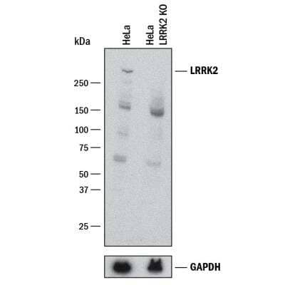 Knockout Validated: LRRK2 Antibody [NB110-58771]