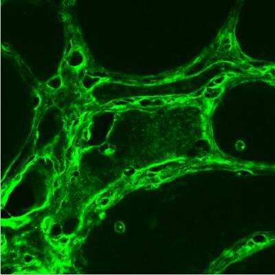 Immunohistochemistry-Frozen: LRRK2 Antibody Pack [NB100-938]