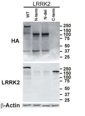 Western Blot: LRRK2 Antibody Pack [NB100-938]