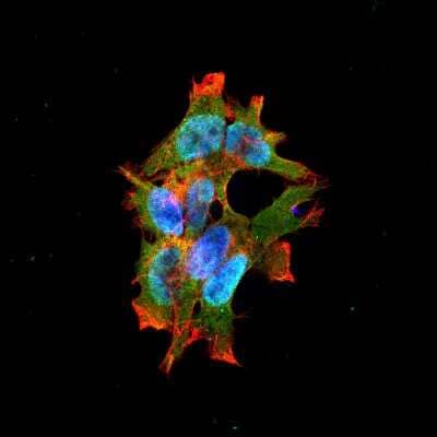 Immunocytochemistry/ Immunofluorescence: LRRK2 Antibody (S138-6) [NBP2-42175]