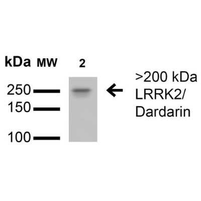 Western Blot: LRRK2 Antibody (S138-6) [NBP2-42175]