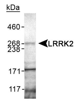 Western Blot: LRRK2 Antibody [NB110-55289]