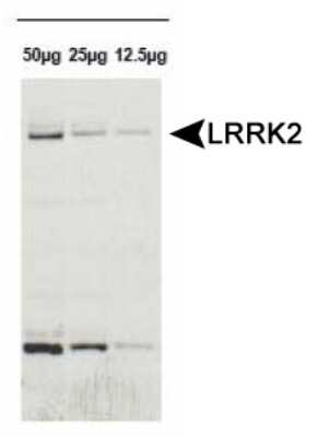 Western Blot: LRRK2 Antibody [NB110-58771]