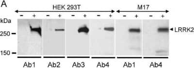 Western Blot: LRRK2 AntibodyBSA Free [NB300-268]