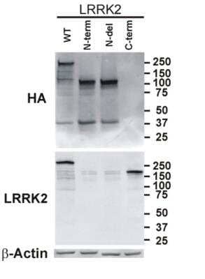Western Blot: LRRK2 AntibodyBSA Free [NB300-268]