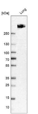 Western Blot: LRRK2 Antibody [NBP2-48524]