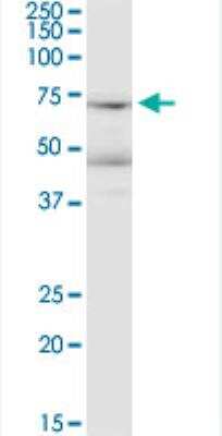 Western Blot: LRRN1/NLRR-1 Antibody (3D11) [H00057633-M05-100ug]
