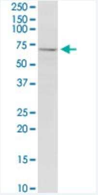 Western Blot: LRRN1/NLRR-1 Antibody (3D11) [H00057633-M05-100ug]