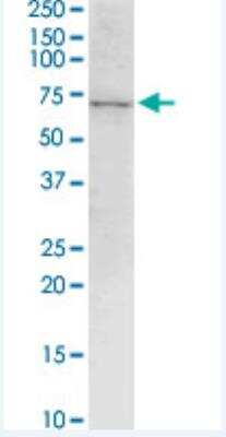 Western Blot: LRRN1/NLRR-1 Antibody (3D11) [H00057633-M05-100ug]