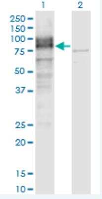 Western Blot: LRRN1/NLRR-1 Antibody (3D11) [H00057633-M05-100ug]