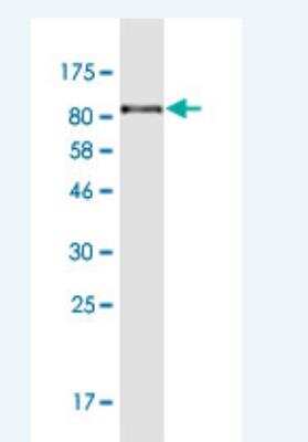 Western Blot: LRRN1/NLRR-1 Antibody (3F1) [H00057633-M11-100ug]