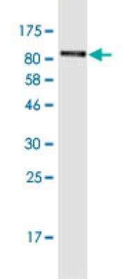 Western Blot: LRRN1/NLRR-1 Antibody (4G8) [H00057633-M09-100ug]