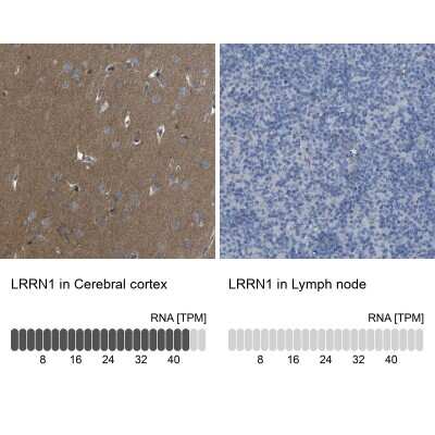 Immunohistochemistry-Paraffin: LRRN1/NLRR-1 Antibody [NBP1-83896]