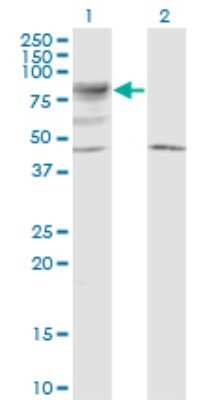 Western Blot: LRRN2 Antibody (6A9) [H00010446-M01]