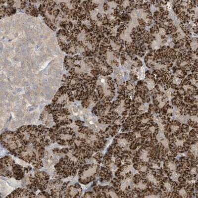 Immunohistochemistry-Paraffin: LRRN2 Antibody [NBP1-84686]