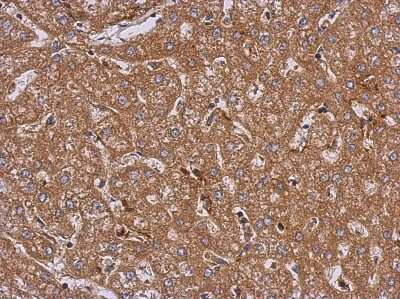 Immunohistochemistry-Paraffin: LRRN2 Antibody [NBP2-17175]