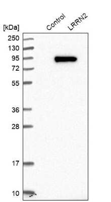 Western Blot: LRRN2 Antibody [NBP1-84686]