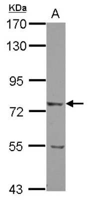 Western Blot: LRRN2 Antibody [NBP2-17175]