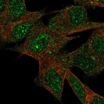 Immunocytochemistry/ Immunofluorescence: LRRN3/NLRR-3 Antibody [NBP2-30614]