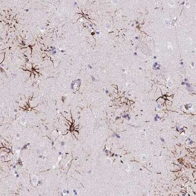 Immunohistochemistry-Paraffin: LRRN3/NLRR-3 Antibody [NBP2-30614]