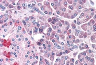 Immunohistochemistry-Paraffin: LRRN4 Antibody [NBP3-14394]