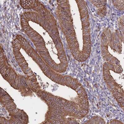 Immunohistochemistry-Paraffin: LRRN4CL Antibody [NBP2-30871]
