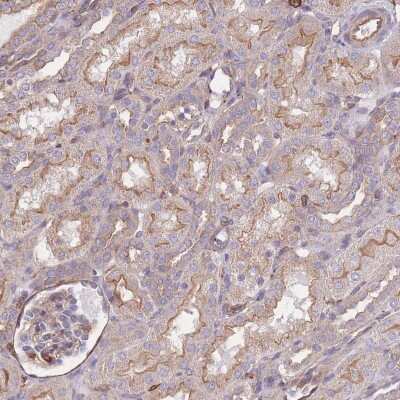 Immunohistochemistry-Paraffin: LRRN4CL Antibody [NBP2-30871]