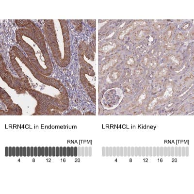 Immunohistochemistry-Paraffin: LRRN4CL Antibody [NBP2-30871]