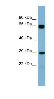 Western Blot: LRRN4CL Antibody [NBP1-60105]