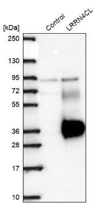 Western Blot: LRRN4CL Antibody [NBP2-30871]