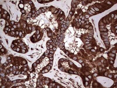 Immunohistochemistry: LRRTM1 Antibody (OTI5H9) [NBP2-45675]