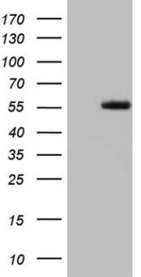 Western Blot: LRRTM1 Antibody (OTI5H9) [NBP2-45675]