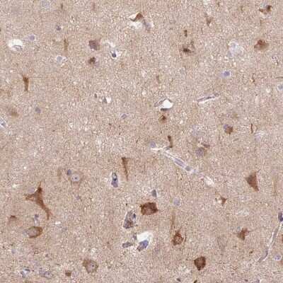 Immunohistochemistry: LRRTM1 Antibody [NBP2-37998]