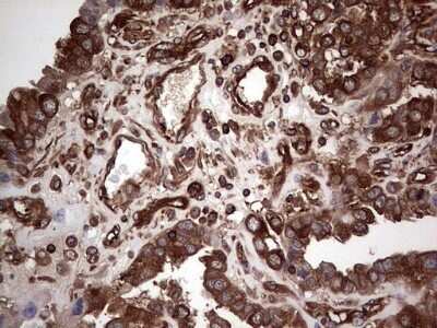 Immunohistochemistry: LRRTM1 Antibody (OTI5H9) - Azide and BSA Free [NBP2-72543]