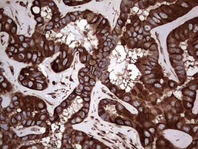 Immunohistochemistry: LRRTM1 Antibody (OTI5H9) - Azide and BSA Free [NBP2-72543]