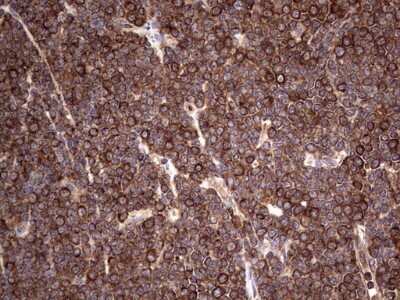 Immunohistochemistry: LRRTM1 Antibody (OTI5H9) - Azide and BSA Free [NBP2-72543]