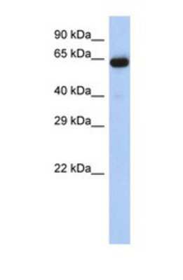 Western Blot: LRRTM1 Antibody [NBP1-69330]