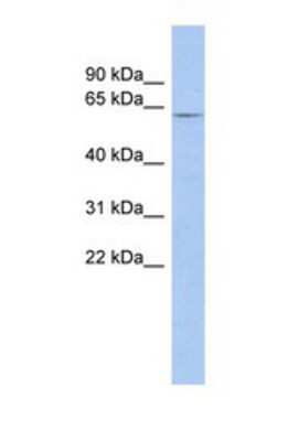 Western Blot: LRRTM1 Antibody [NBP1-69331]