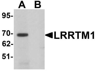 Western Blot: LRRTM1 AntibodyBSA Free [NBP1-76528]