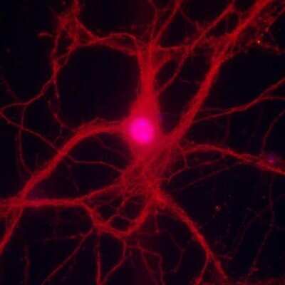 Immunocytochemistry/ Immunofluorescence: LRRTM2 Antibody - BSA Free [NBP2-41129]