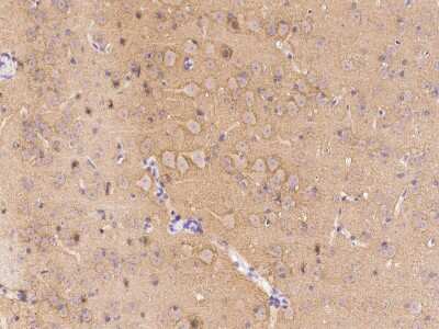 Immunohistochemistry-Paraffin: LRRTM2 Antibody [NBP2-98780]