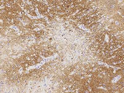 Immunohistochemistry-Paraffin: LRRTM2 Antibody [NBP2-98780]