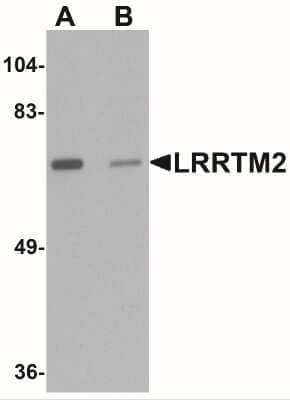 Western Blot: LRRTM2 AntibodyBSA Free [NBP2-41129]