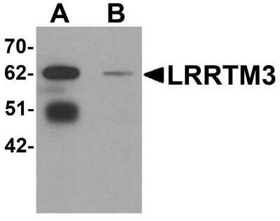 Western Blot: LRRTM3 AntibodyBSA Free [NBP1-76529]